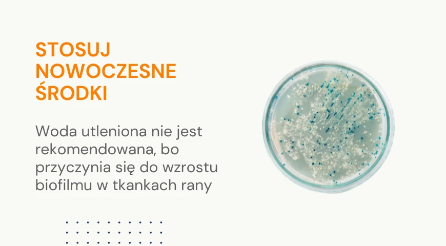 Stosuj nowoczesne środki